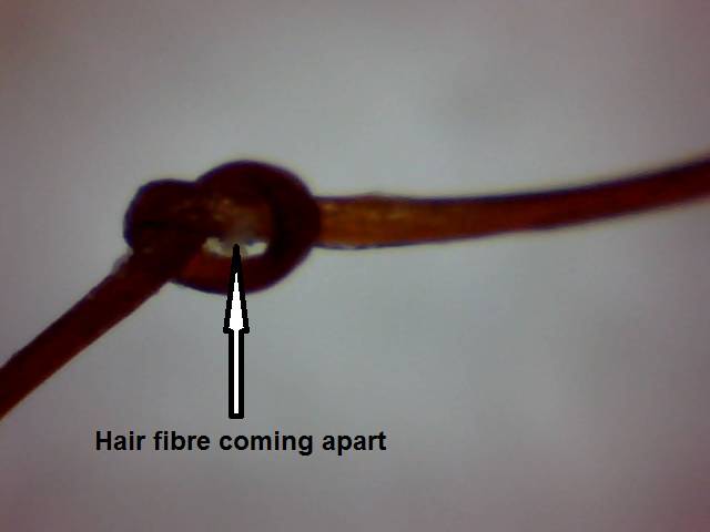 Simple knot with hair fibre damage