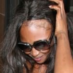 Naomi Campbell bald hairline