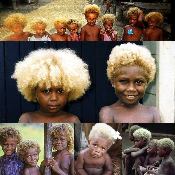 Fascinating The Melanesians Have Dark Skin And Naturally Blonde