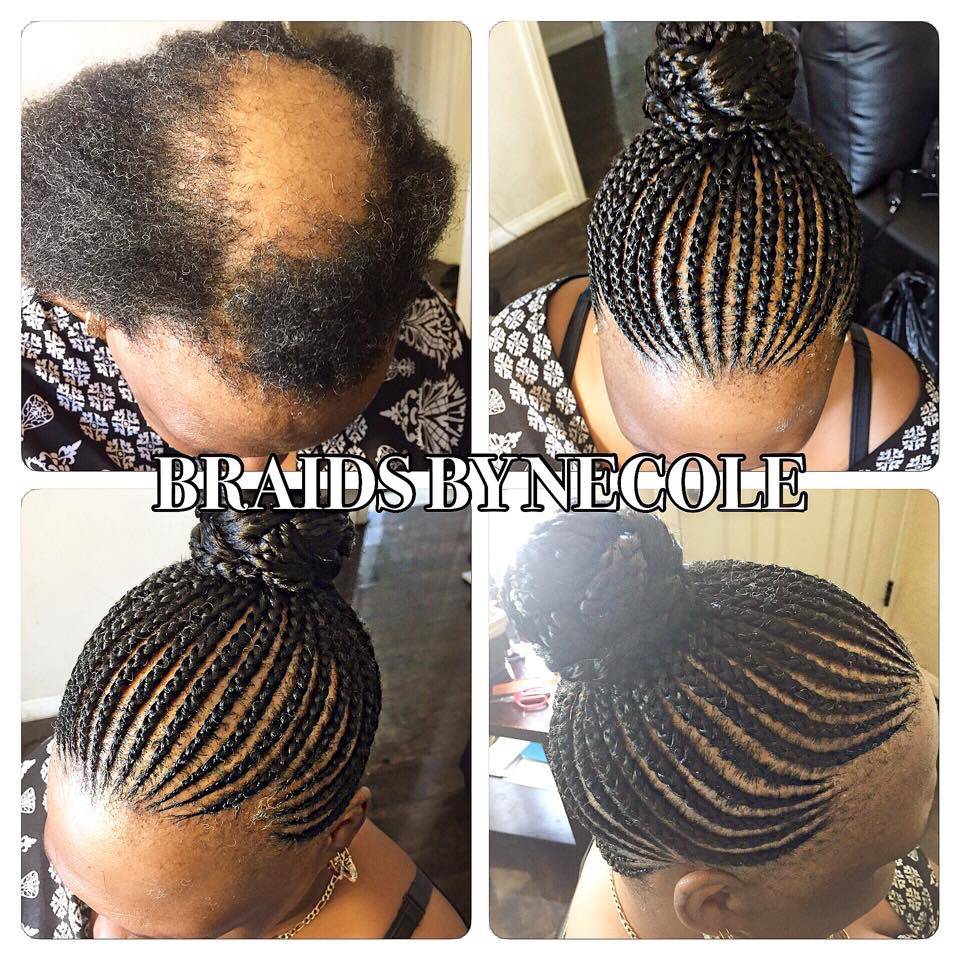 Pin by Shatari Braids on Alopecia Camouflage