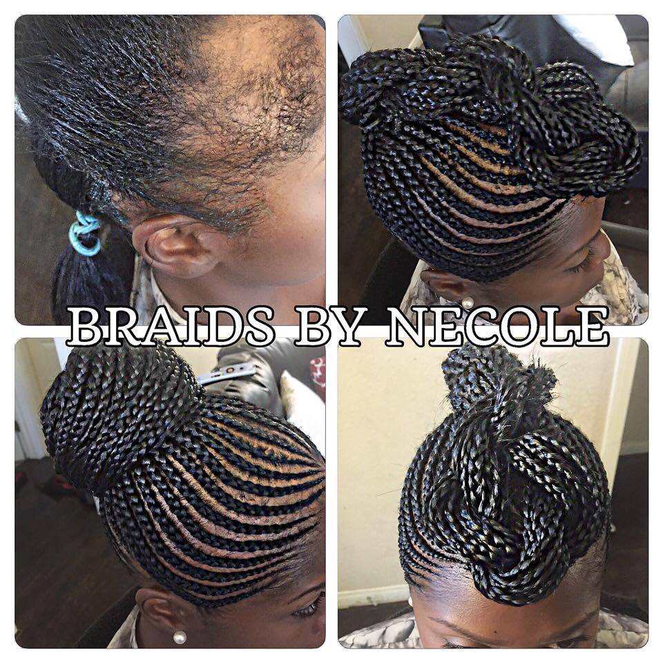 14 Extraordinary Alopecia Camouflage Cornrows By Braids By Necole - Black  Hair Information