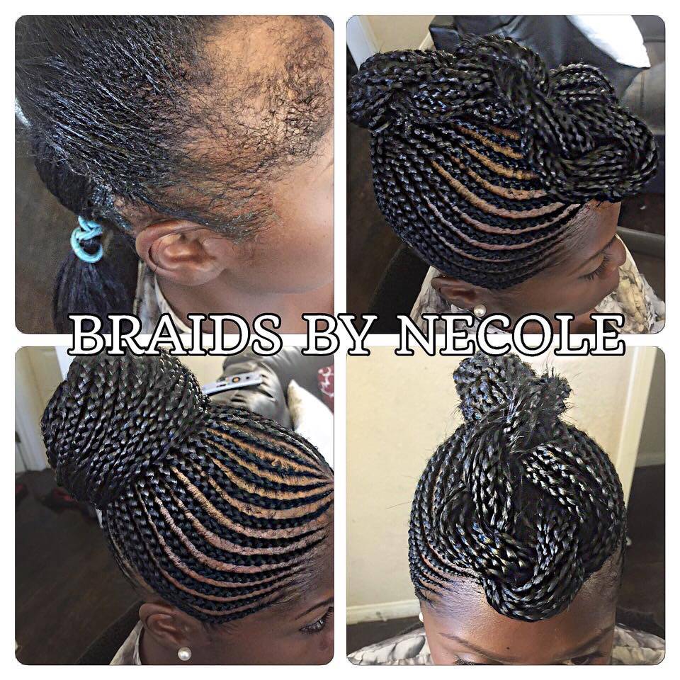 14 Extraordinary Alopecia Camouflage Cornrows By Braids By