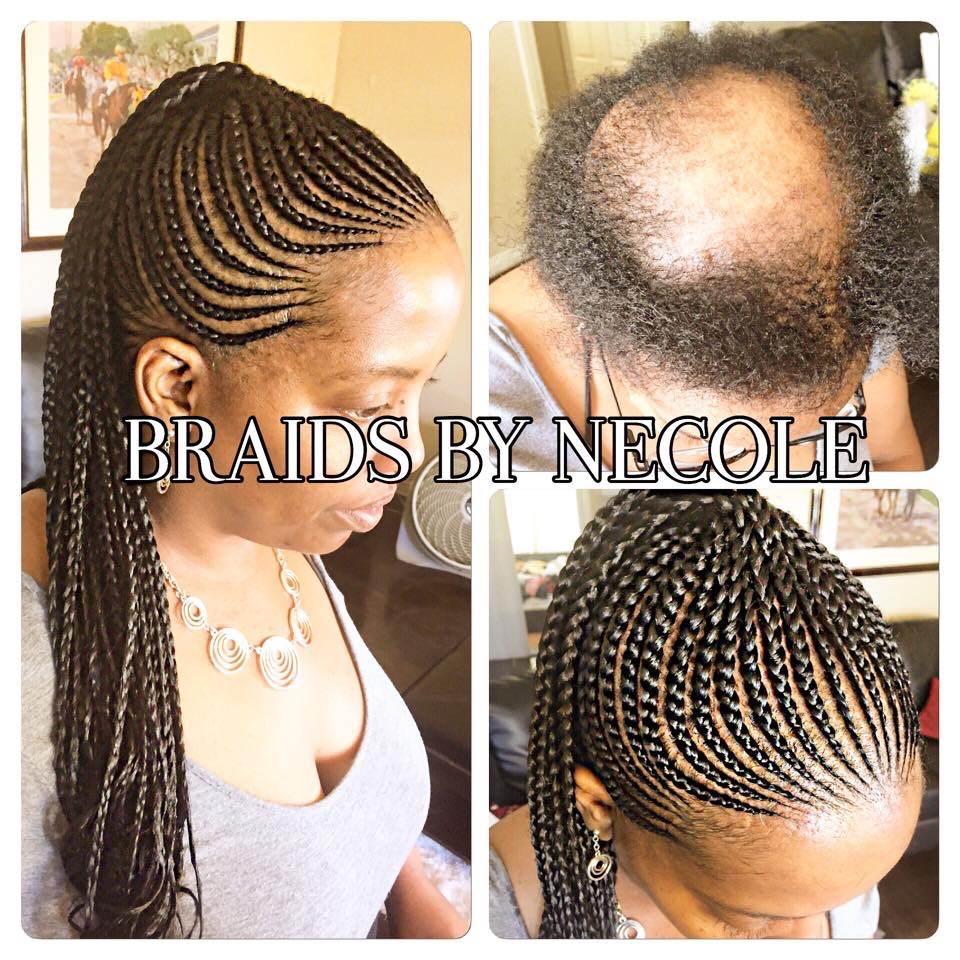 14 Extraordinary Alopecia Camouflage Cornrows By Braids By Necole