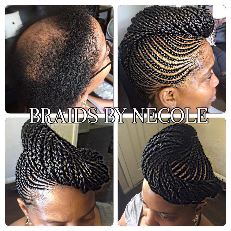 14 Extraordinary Alopecia Camouflage Cornrows By Braids By Necole - Black  Hair Information