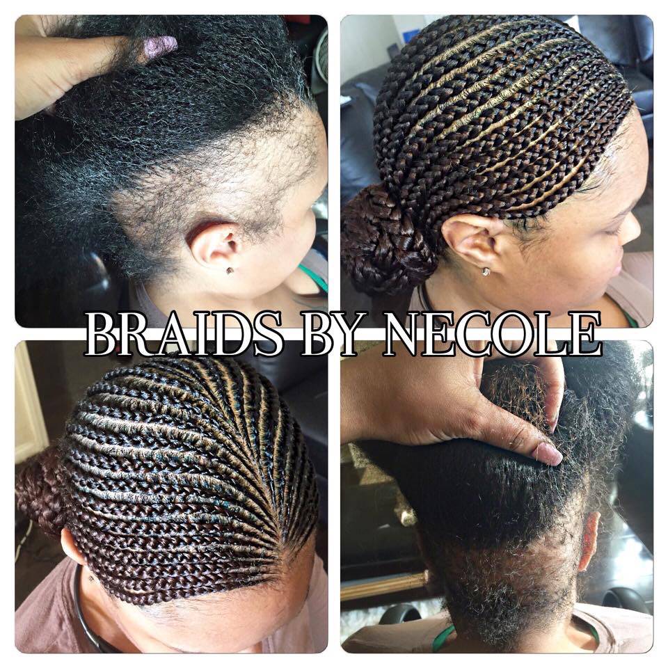 14 Extraordinary Alopecia Camouflage Cornrows By Braids By Necole Black Hair Information
