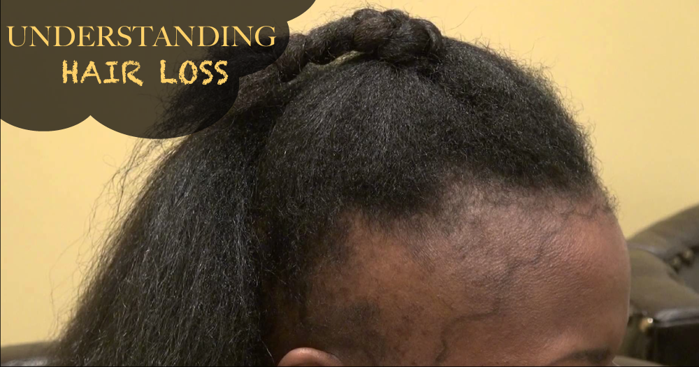 12 Reasons Why You May Be Experiencing Mild To Severe Hair Loss - Black Hair  Information