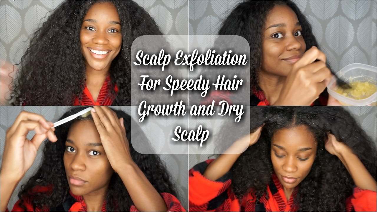 How To: Scalp Exfoliation for Faster Hair Growth and Dry ...
