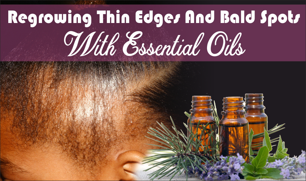 Regrowing Thin Edges And Bald Spots Caused By Alopecia With